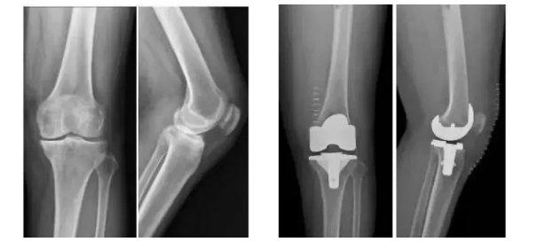 621636700907647.png blob.png