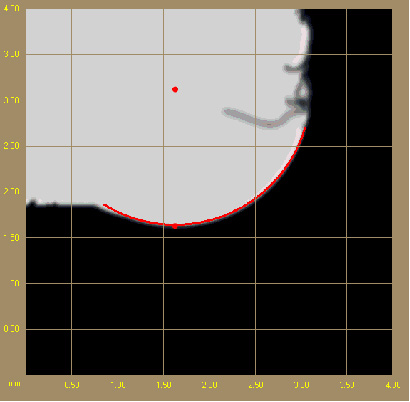 高頻油污的過(guò)濾
